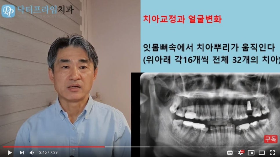 얼굴이 이뻐지는 치아교정! (덧니, 비대칭, 돌출입) 관련 이미지 5