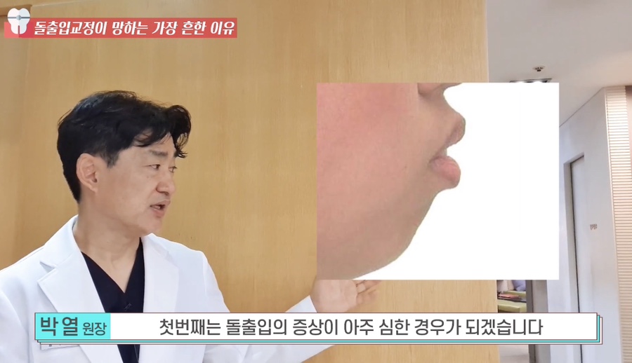 돌출입 교정치과 옥니 돌출입 치아 교정 왜 망할까? 관련 이미지 10