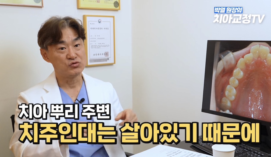 강남역치아교정, 신경치료 받은 치아도 교정이 될까? 관련 이미지 20