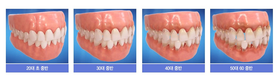 빠르면 빠른 수록 좋은 빠른 교정의 중요성! 관련 이미지 4
