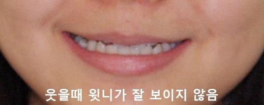 매력적으로 미소짓는 법! 관련 이미지 4
