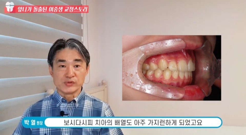 돌출입교정후기(여중생) 관련 이미지 12