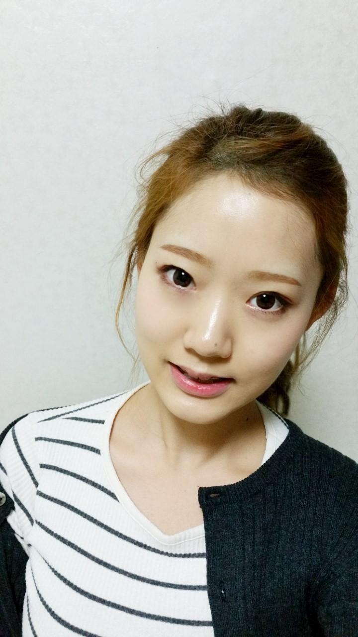 [치아교정후기] 앞니돌출교정후기(15) 관련 이미지 1