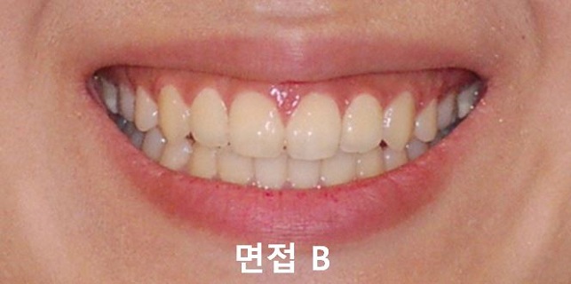 면접과 미소! 관련 이미지 4