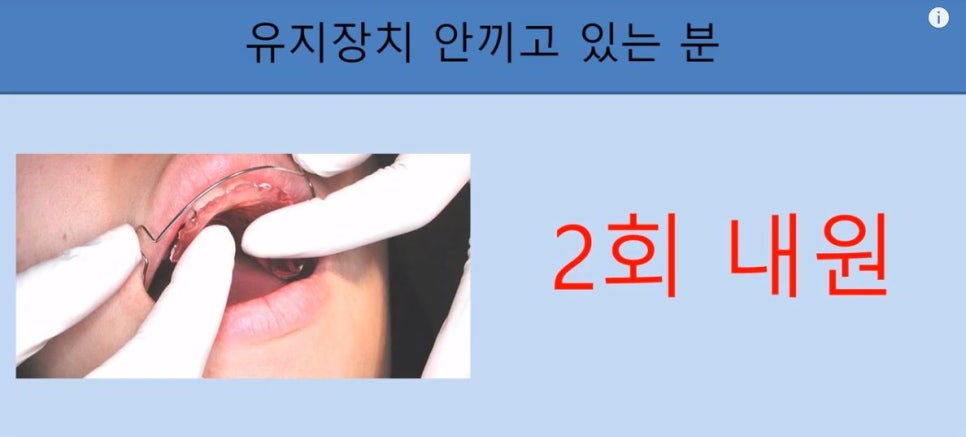 [치아교정] 치아교정 끝나고 요새 유지장치 안끼시는 분들 꼭 보시고 새출발하세요~~!! (돌출입교정, 덧니교정, 양악수술교정, 앞니교정한 분들 모두 해당됩니다) 관련 이미지 9