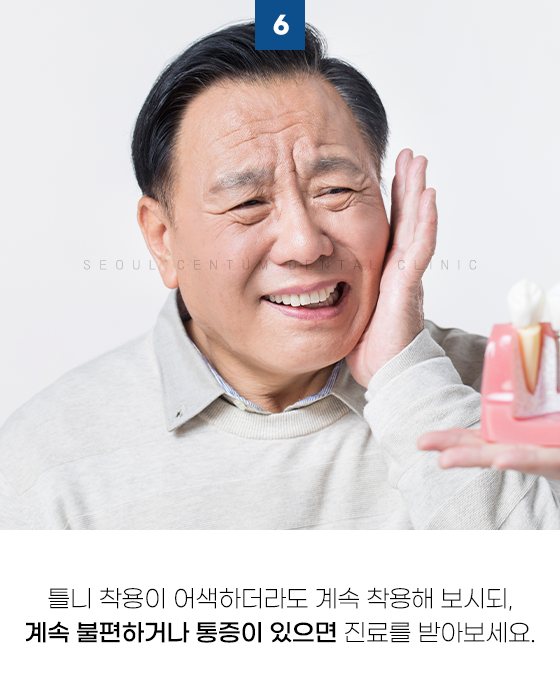 틀니임플란트 주의사항 알면 장점을 더 누릴 수 있어요 관련 이미지 10