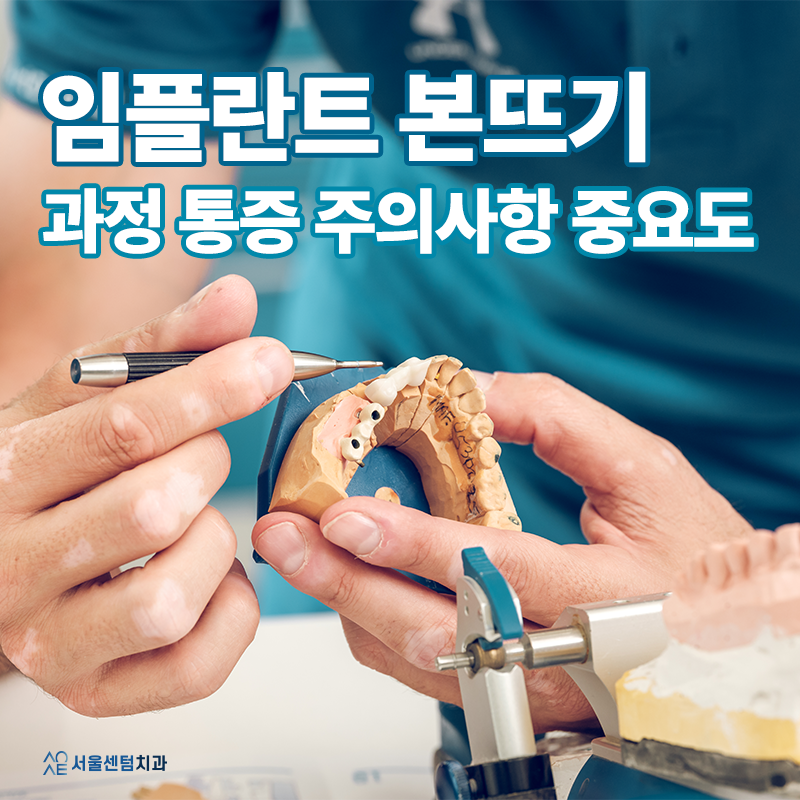 Why Is the Dental Implant Impression-Taking Process and Its Pain Precautions Important? image 1