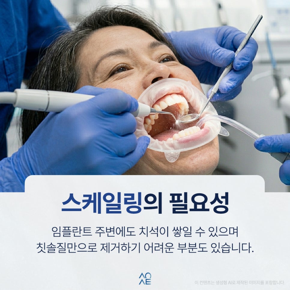 임플란트 정기검진 전체했는데 주기 궁금해요 1년에 몇 번 받아야 하나요 관련 이미지 6