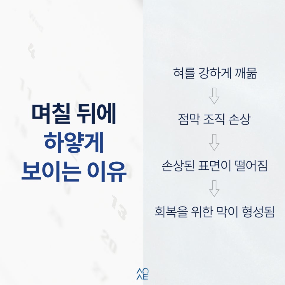 혓바닥 구내염 혀 세게 깨물었다가 생길 수 있는 건가요? 관련 이미지 3