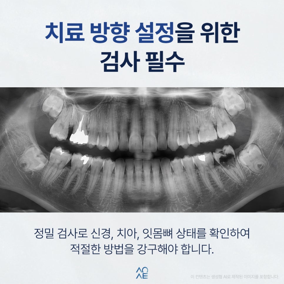Crown or Implant—which Should I Choose? Guidelines for Deep Cavities image 2