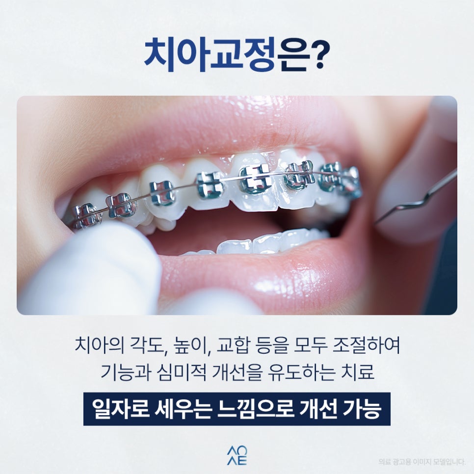 왜소치 교정 치아 기울어진 느낌 개선 가능? 라미네이트도 필요한가요 관련 이미지 2