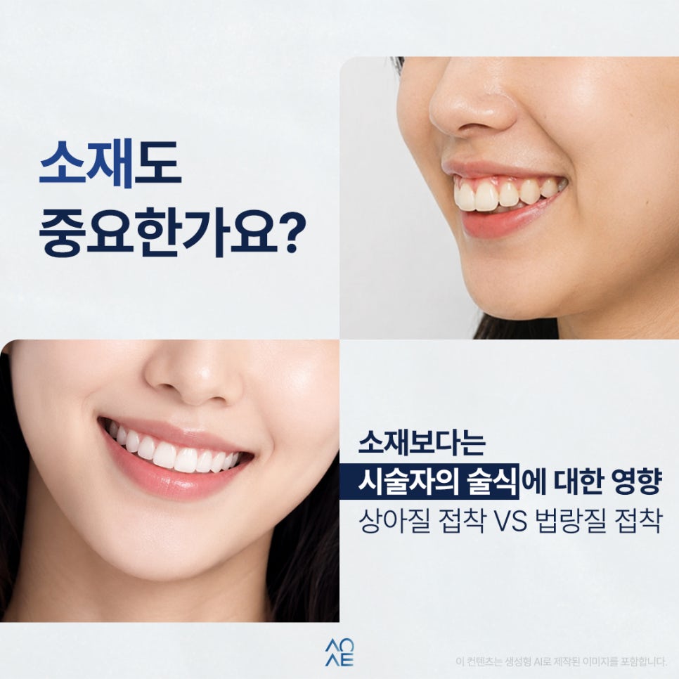 라미네이트 수명 언제까지 몇년 유지가 가능한건가요? 평생도 가능한가요? 관련 이미지 4