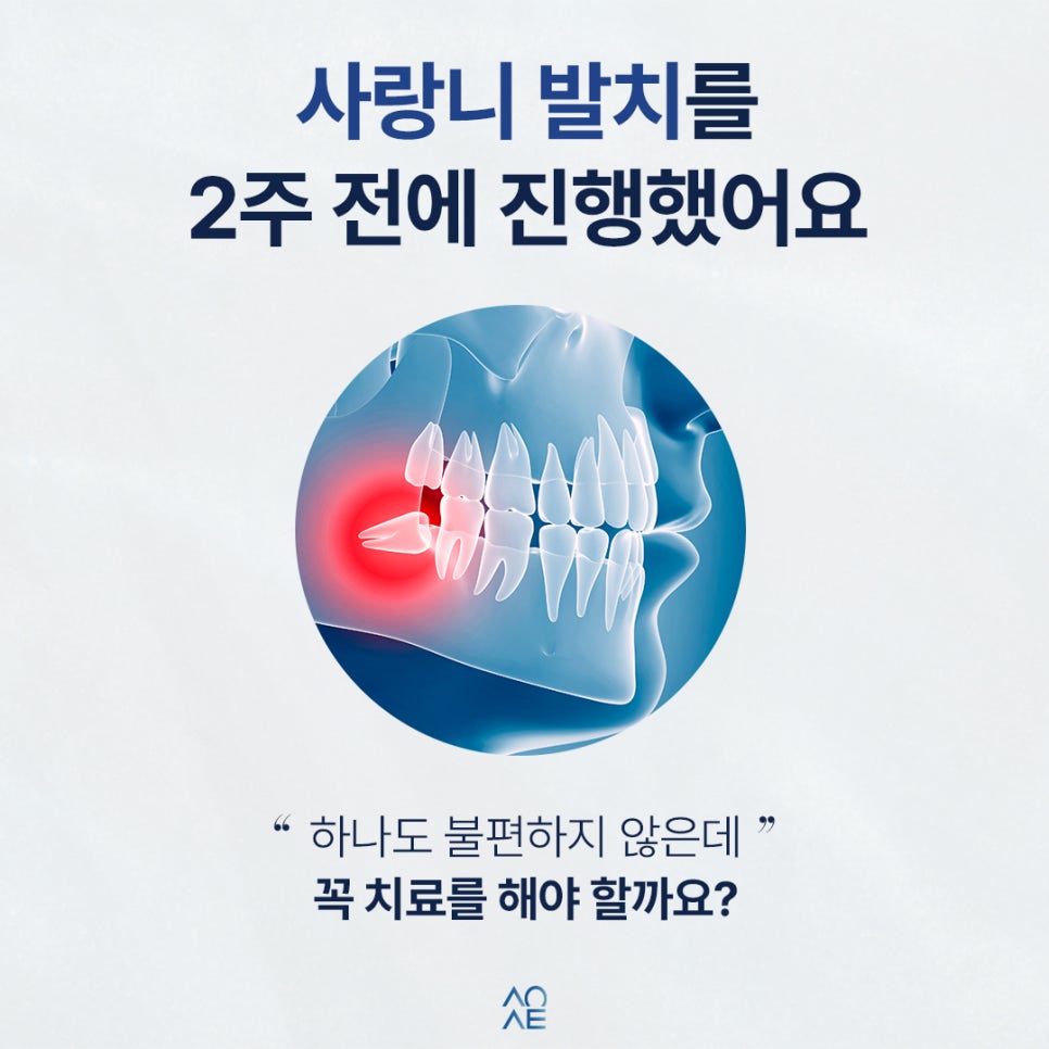 치과에서 사랑니발치 후 신경치료랑 크라운 하라고 하는데 진짜 꼭 해야할까요? 관련 이미지 2