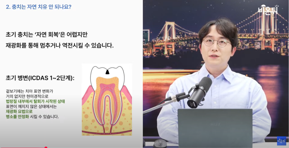 의학채널 비온뒤 유튜브 채널 첫출연 충치 아프면 늦습니다 충치치료법 관련 이미지 11