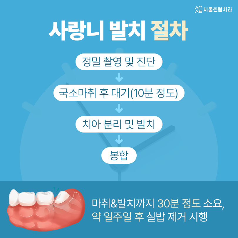 사랑니당일발치 가능한 조건과 준비까지 가이드 잡아드립니다 관련 이미지 4