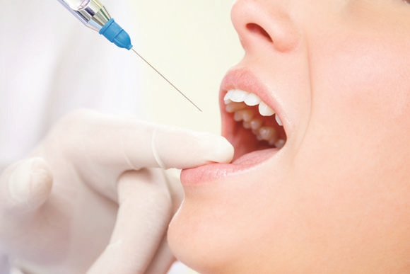 치과 마취 주사 종류, 풀리는 시간 빨리 푸는 방법 관련 이미지 3