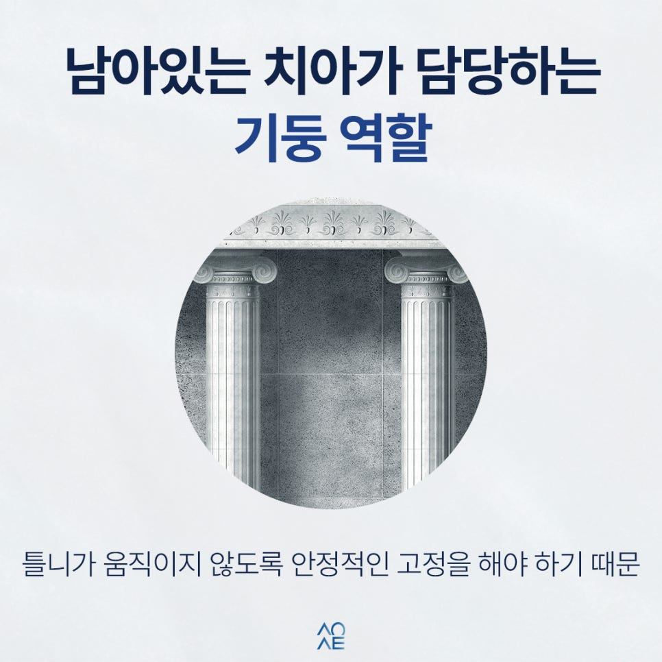 어금니 부분틀니 비용이 높다고요? 이유와 크라운 필요성 알려주세요 관련 이미지 2