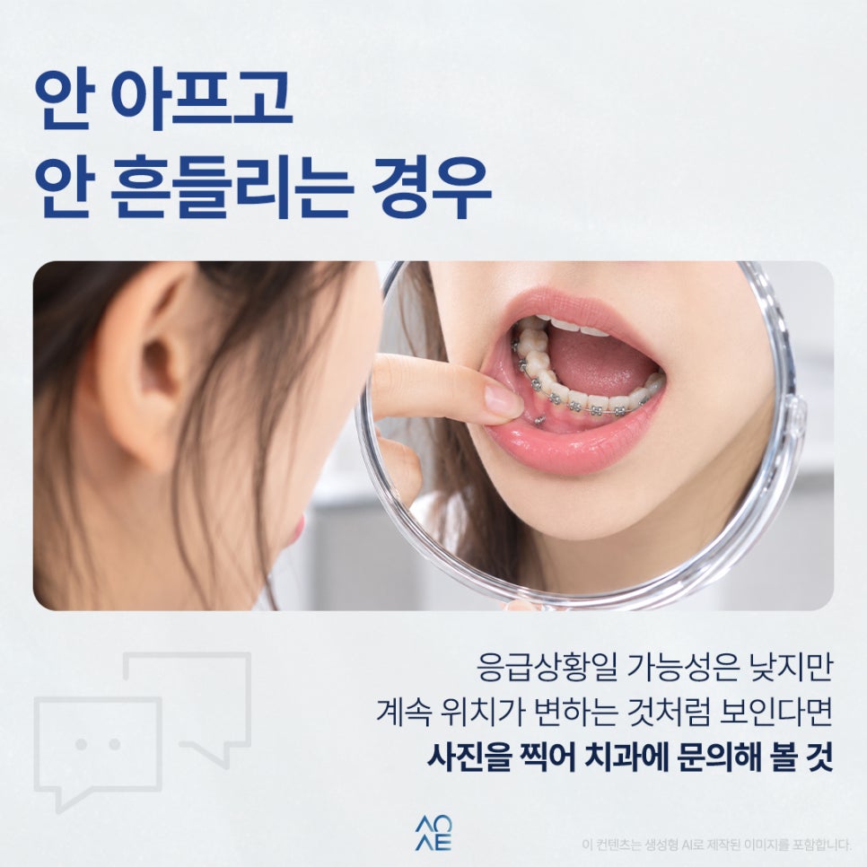 교정 미니스크류 풀리는 것 같은데 그대로 내버려둬도 되나요? 관련 이미지 5