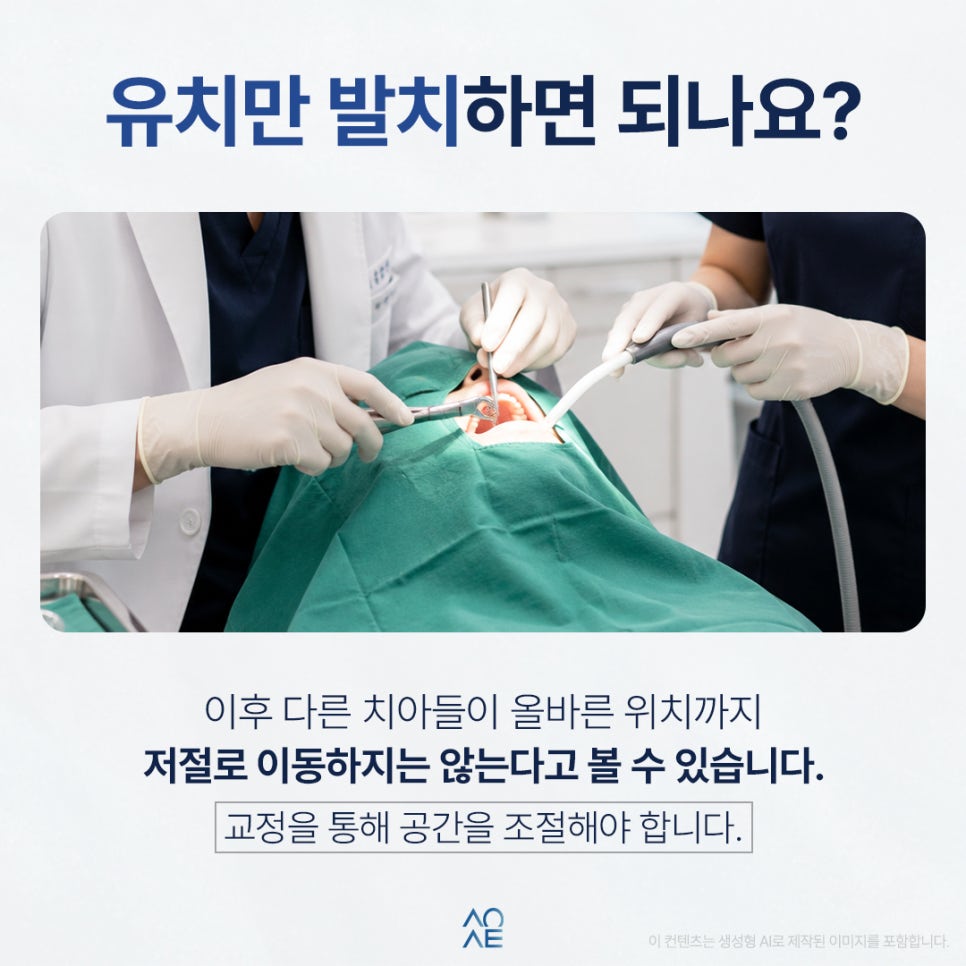 Do I Need Full Orthodontic Treatment After Extracting a Crowded Tooth? image 3