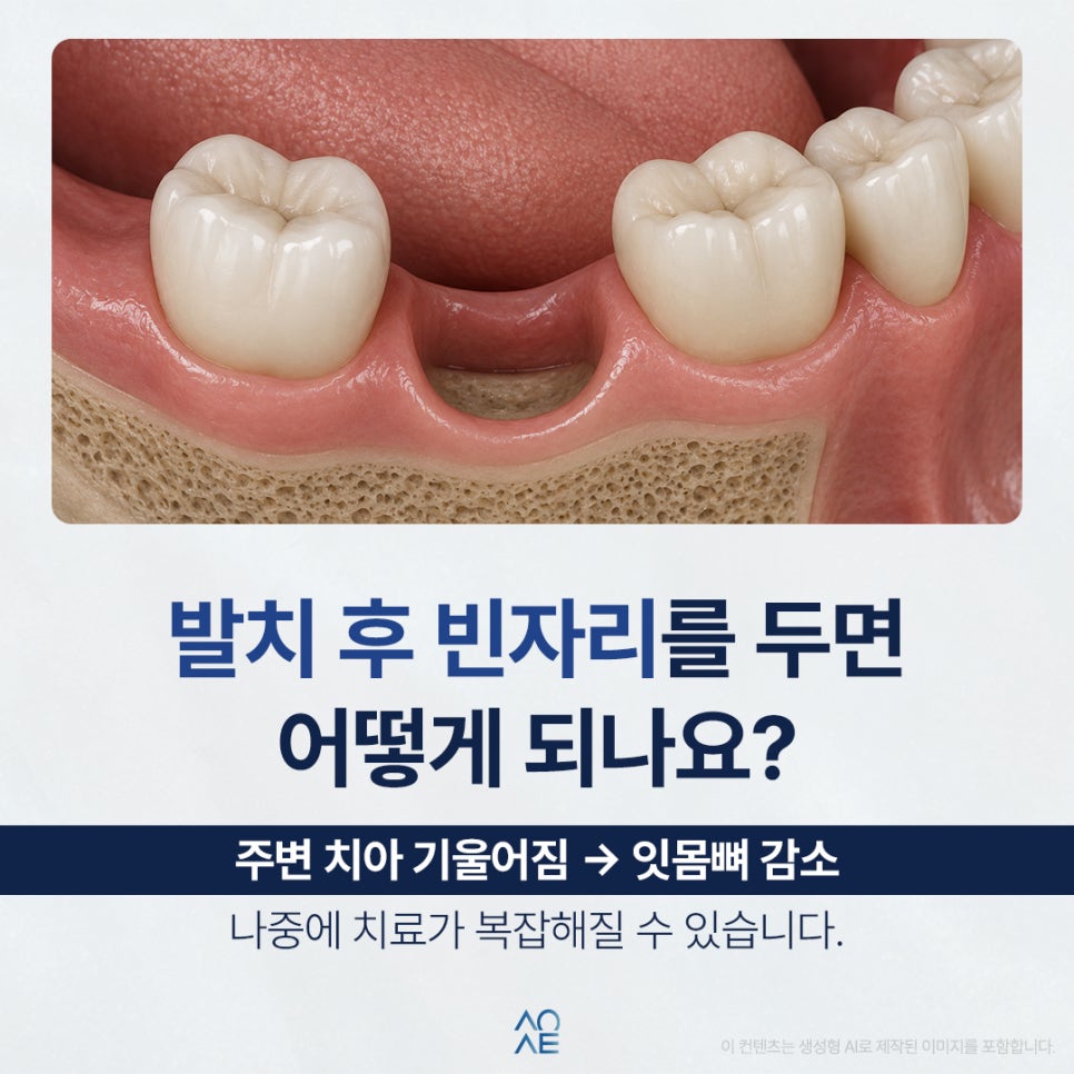 20대 임플란트 해도 괜찮을까요? 아직 나이도 초반인데 어쩌죠 관련 이미지 6
