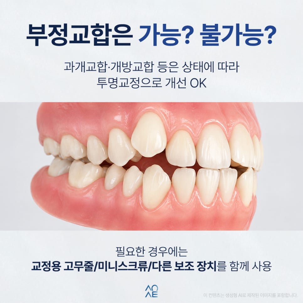 투명교정 비용 얼마나 들죠? 덧니와 부정교합도 가능한지 알고 싶어요 관련 이미지 3