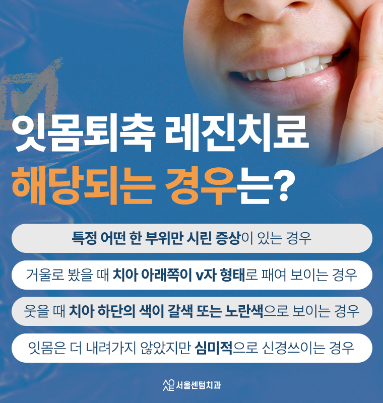 잇몸퇴축 레진치료 생각보다 간단하거든요 관련 이미지 4