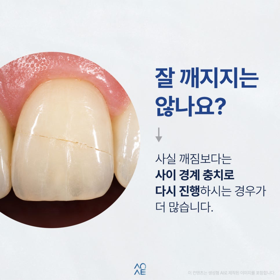라미네이트 수명 언제까지 몇년 유지가 가능한건가요? 평생도 가능한가요? 관련 이미지 3