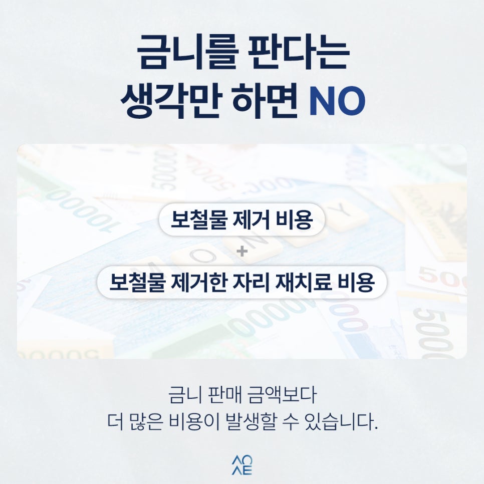 금니 판매 시세 금액 얼마나 이득볼까? 치료비도 계산해 본다면 관련 이미지 4