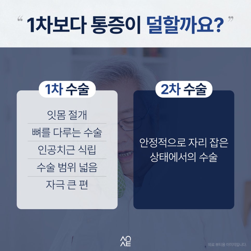임플란트 2차 수술 후기 생각보다 안 아팠다는 말이 많은 이유 관련 이미지 3