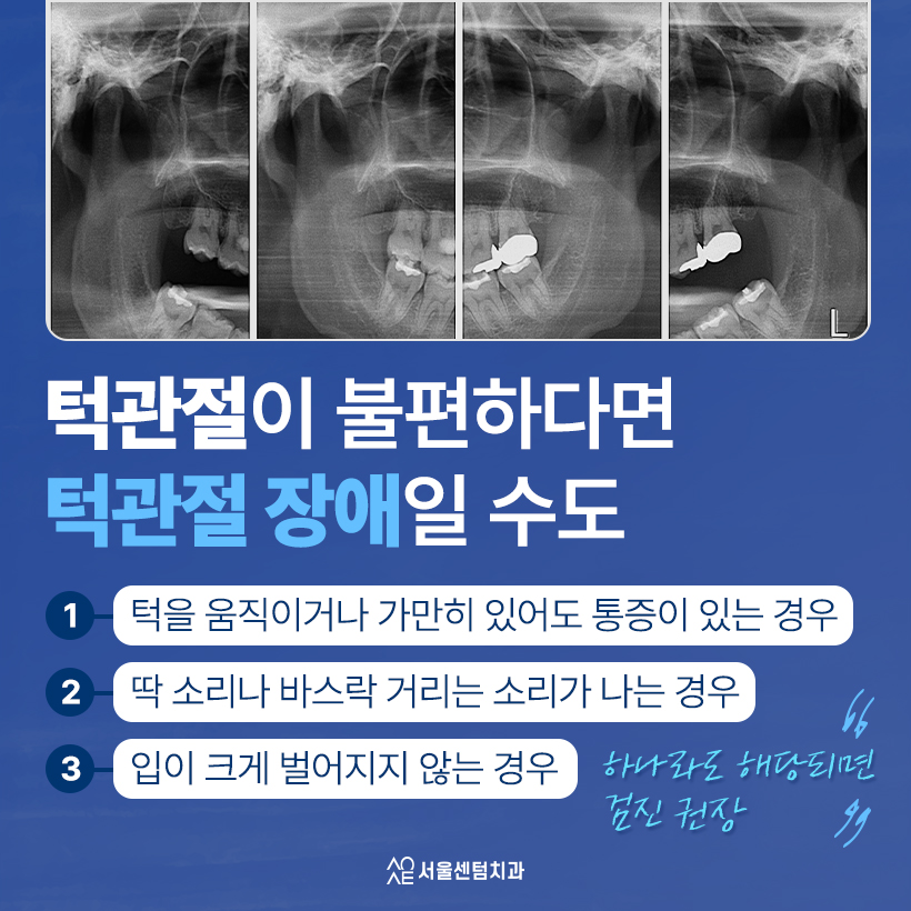 턱통증 불편하다면 원인과 완화 방법 실마리 찾기 관련 이미지 2