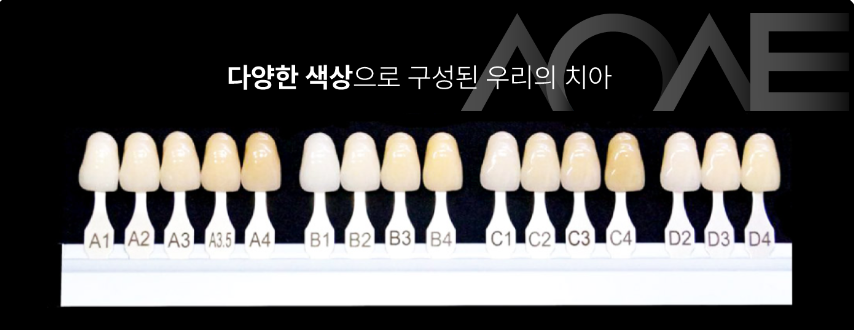 [신사역 치과] 원데이 치아미백 효과와 유지기간은 관련 이미지 4