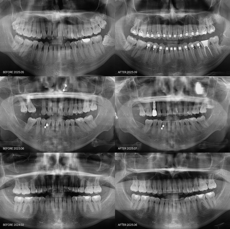 턱통증 불편하다면 원인과 완화 방법 실마리 찾기 관련 이미지 6