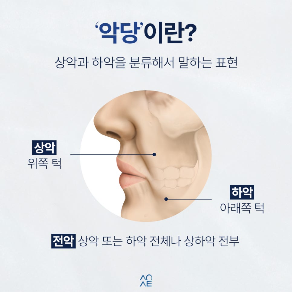 전체임플란트 가격 발품 시 악당 전악 뜻 모르면 헷갈릴 수 있습니다 관련 이미지 2