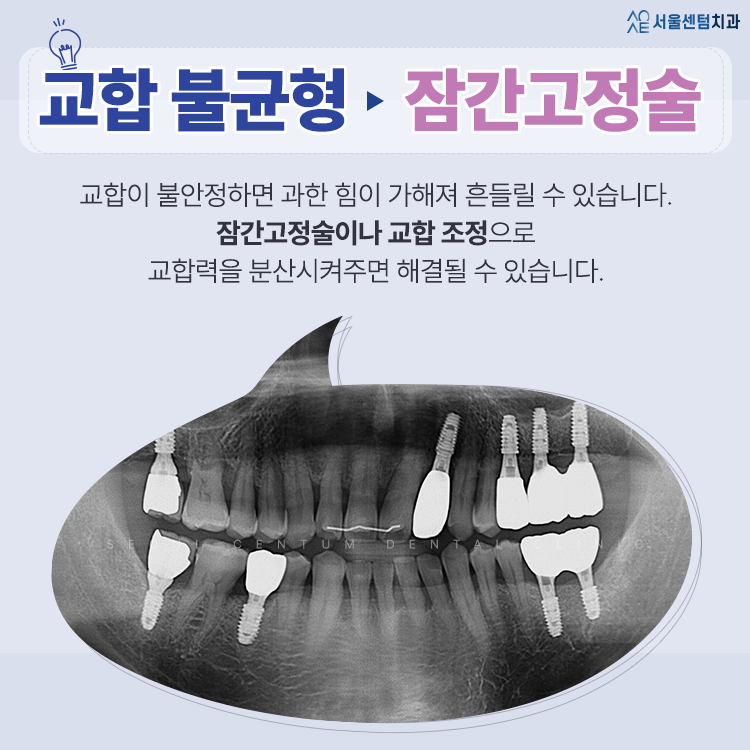 흔들리는 치아 가만히 두지 말고 즉각 치료받아야 하는 경우는? 관련 이미지 3