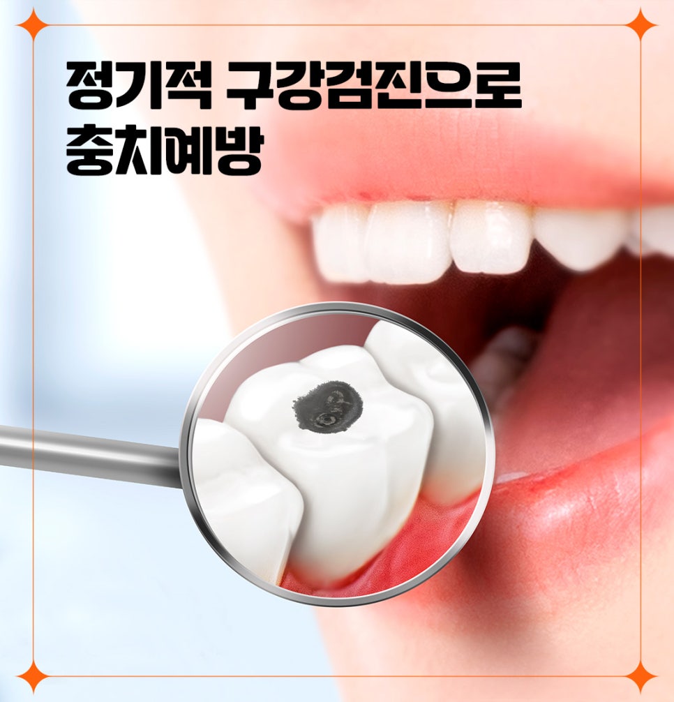 매일 양치해도 충치 생기는 이유 관련 이미지 5