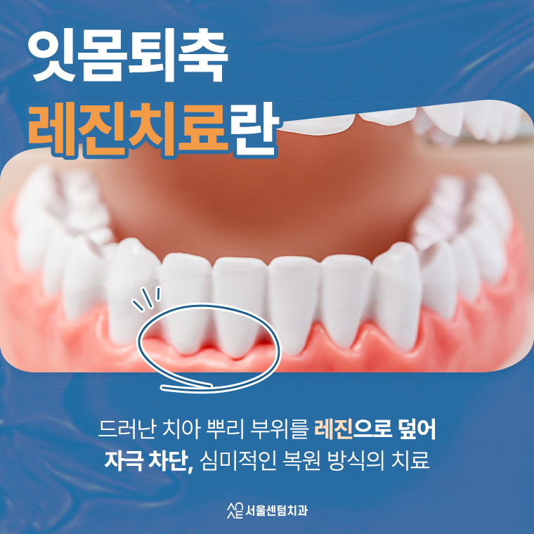 잇몸퇴축 레진치료 생각보다 간단하거든요 관련 이미지 3