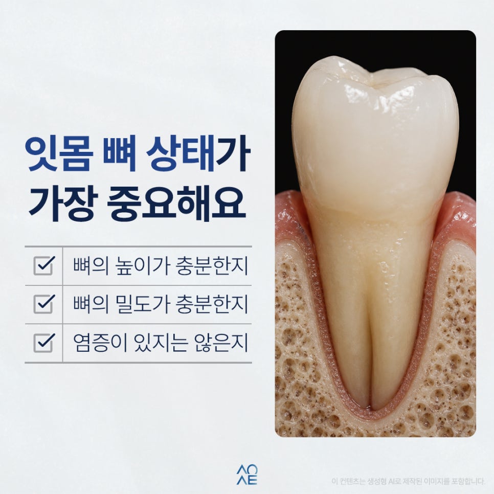 Is It Possible to Have 8 Implants in Your 50s? image 3