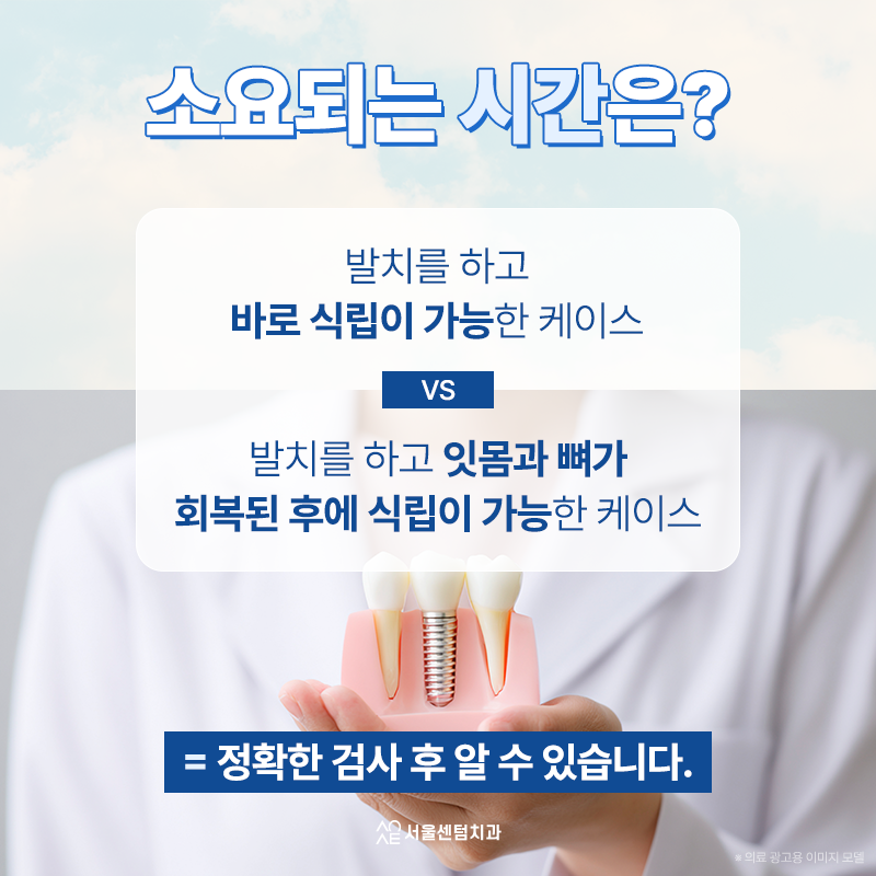 앞니임플란트 후기 찾아보고 골라야 하는 이유 왜 중요할까 관련 이미지 5