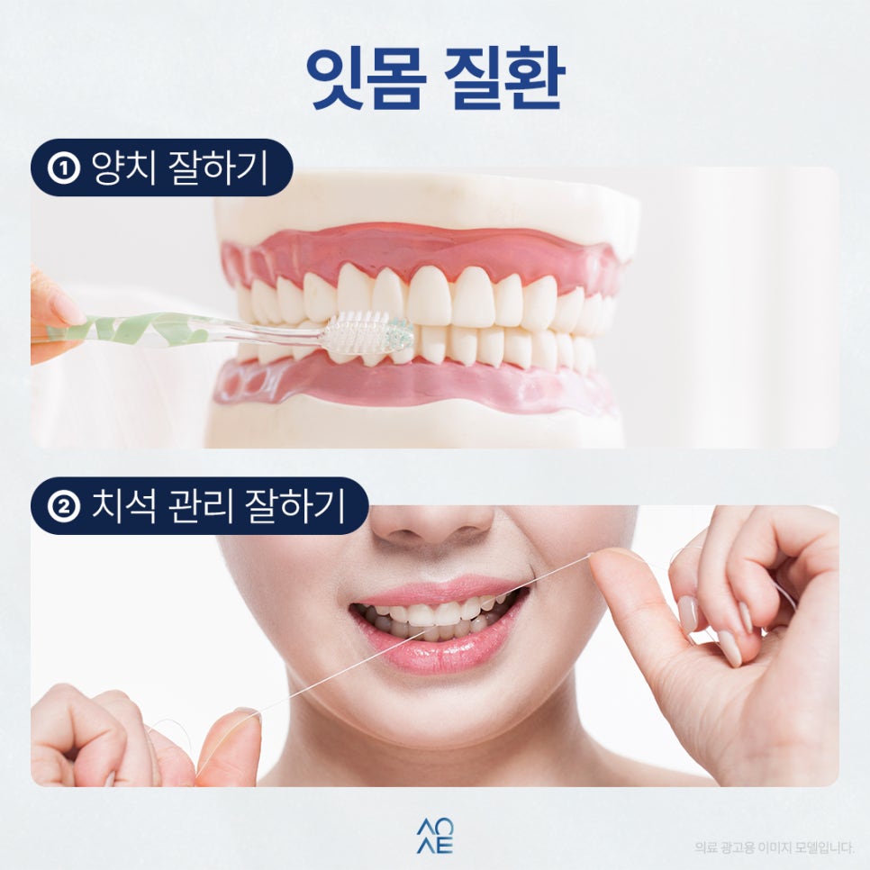 잇몸병에 어디가 좋은건가요? 인사돌 질문 많이 하세요 잇몸질환은 양치로 세균죽이고 인사돌먹나요? 관련 이미지 2