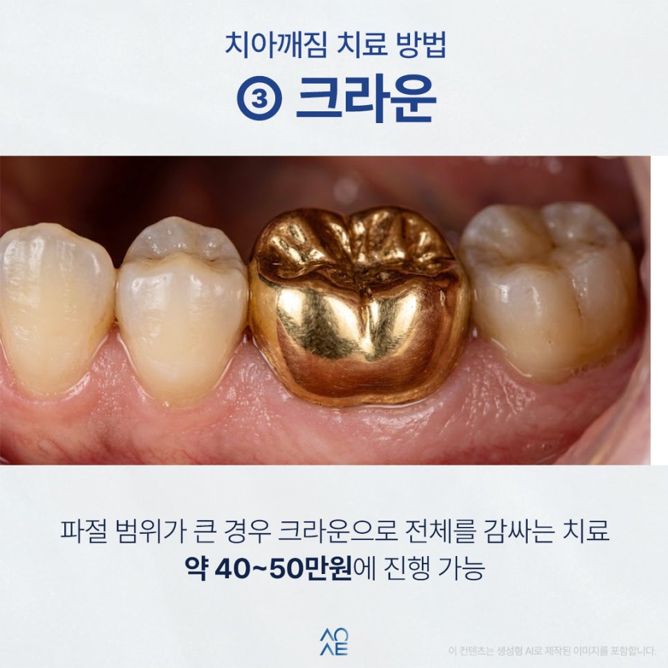Is tooth chipping caused by cavities? I’m also wondering about the treatment cost. Will it be very expensive? image 6