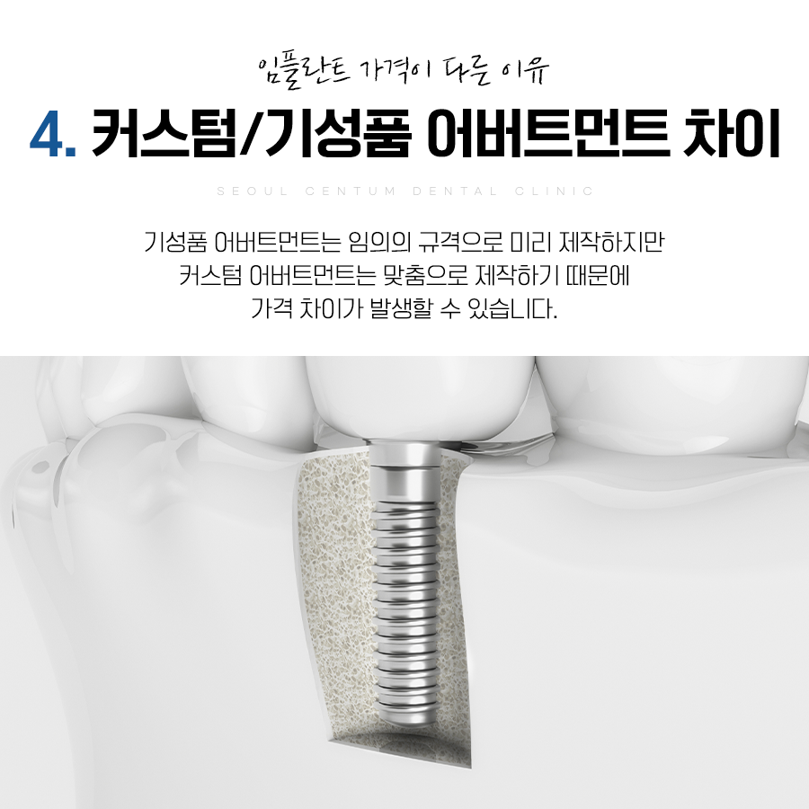 임플란트1개가격 어느 치과든 상관없이 천차만별인 이유 6가지 관련 이미지 8