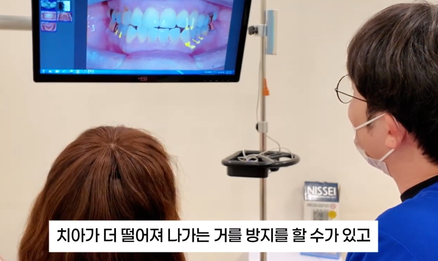 치아패임 이대로 두어도 괜찮을까요 치경부마모증 레진치료 관련 이미지 12