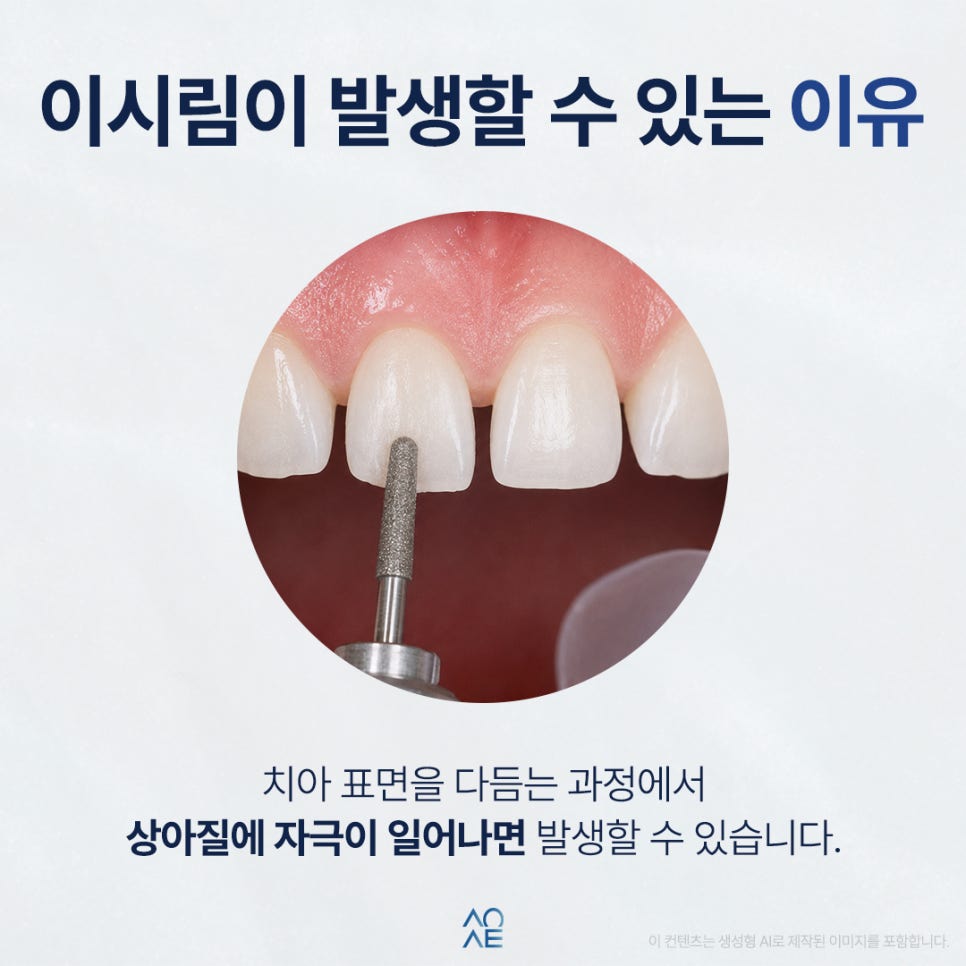 Is Sensitivity Severe After Veneers? What to Check Before Treating Gaps Between the Front Teeth image 2