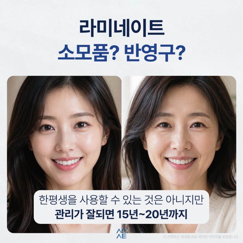 라미네이트 수명 언제까지 몇년 유지가 가능한건가요? 평생도 가능한가요? 관련 이미지 2