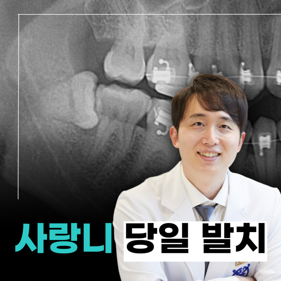 사랑니 발치 통증 붓기 줄이는 법 관련 이미지 9