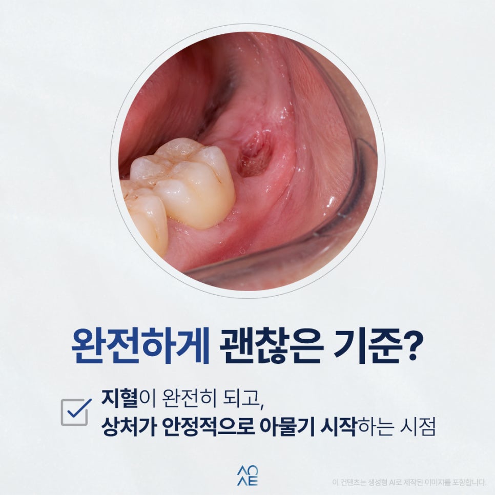 How Many Days Should I Avoid Alcohol After a Tooth Extraction? image 4