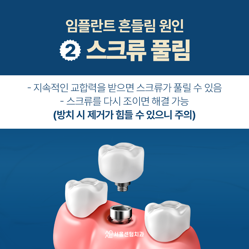 Why You Must Not Ignore a Loose Dental Implant image 3