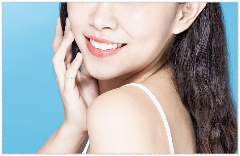 라미네이트 치아삭제량 관련 유익한 정보 관련 이미지 5