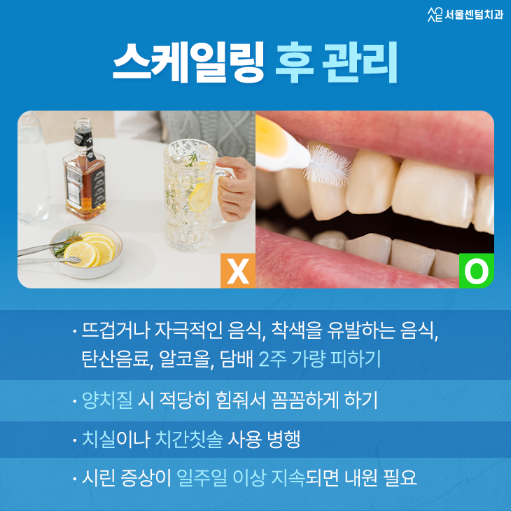 치아 스케일링 주기 알아두면 구강 질환 걱정 끝 관련 이미지 6