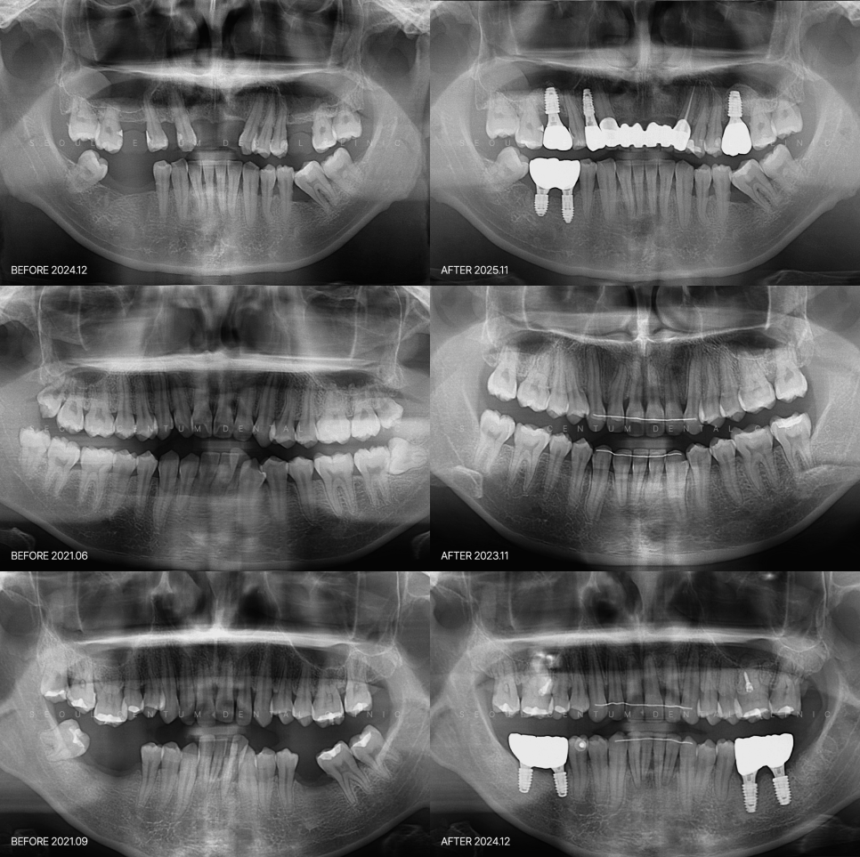 직장인 구강검진 나도 대상자? 올해 넘어가기 전에 체크 관련 이미지 6